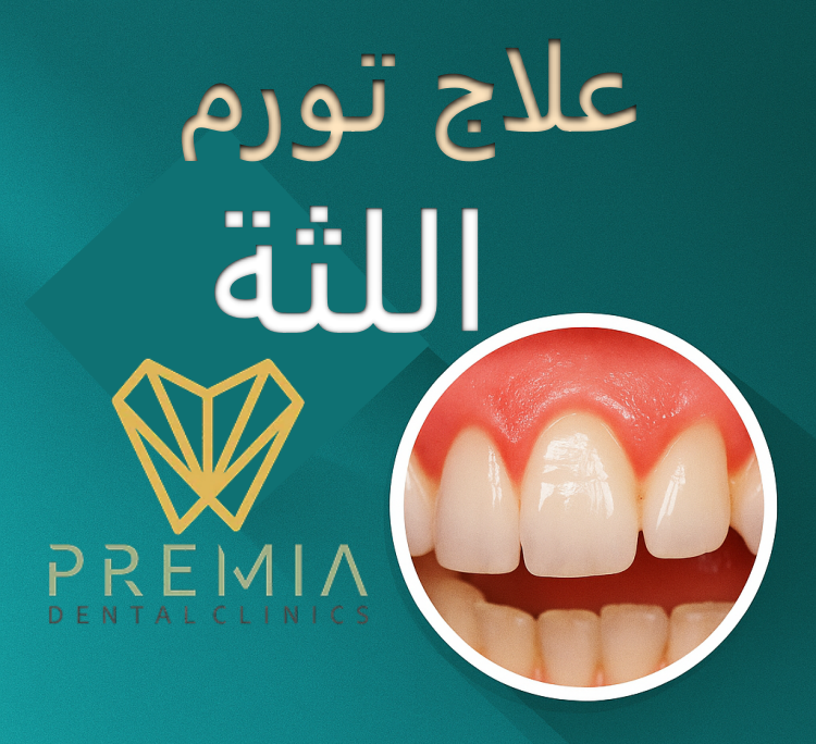 علاج تورم اللثة