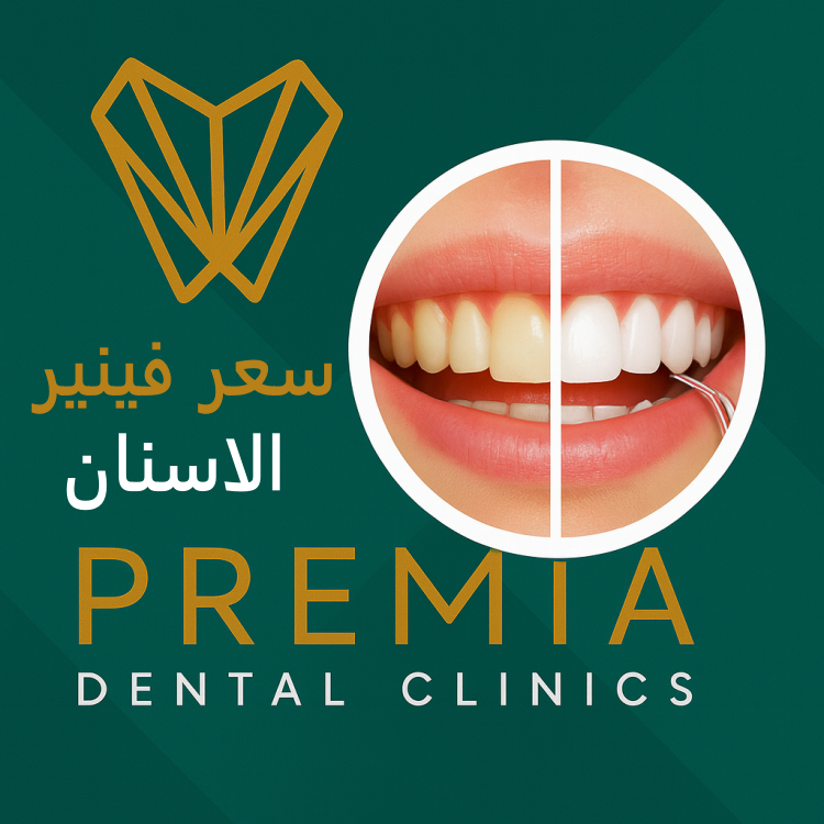 سعر فينير الاسنان