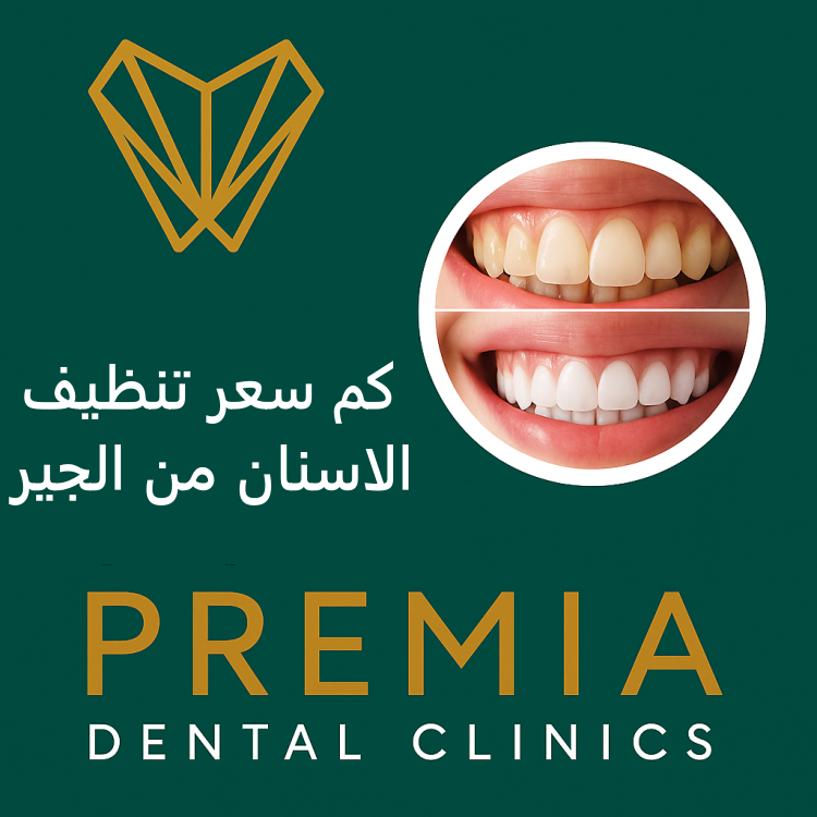 كم سعر تنظيف الاسنان من الجير؟ إليك التفصيل لعام 2025 
