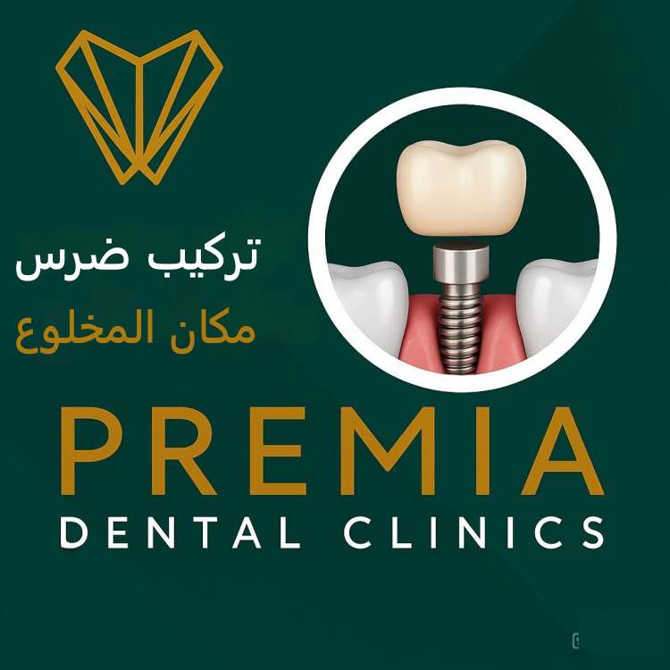 تركيب ضرس مكان المخلوع