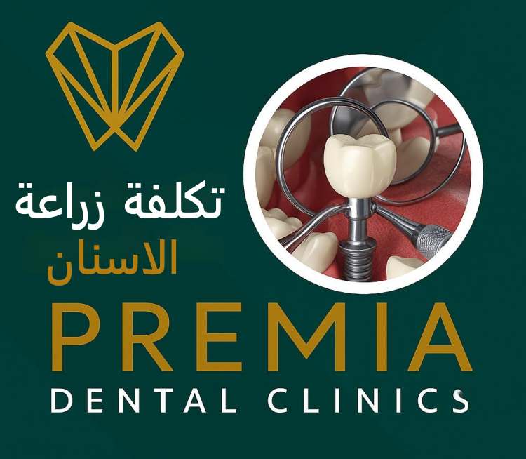 تكلفة زراعة الاسنان