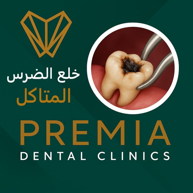 خلع الضرس المتاكل