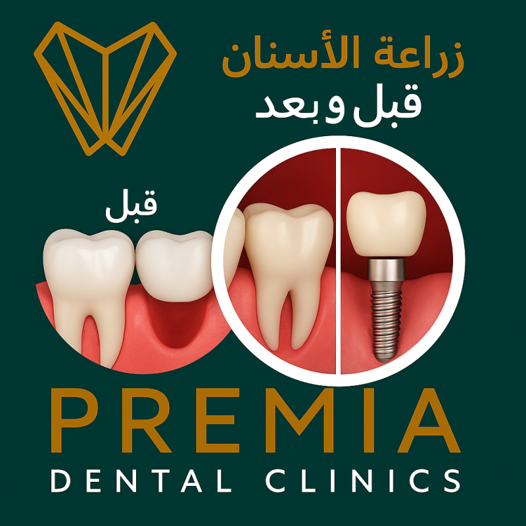 زراعة الاسنان قبل وبعد:تحول واضح في الابتسامة والثقة