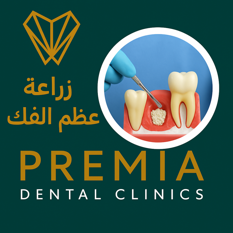 زراعة عظم الفك