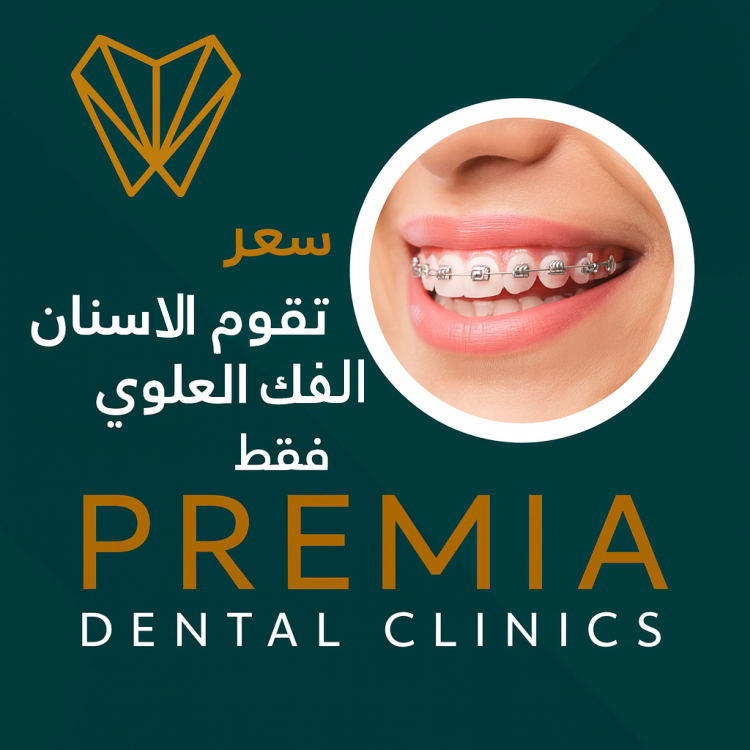 سعر تقويم الاسنان الفك العلوي فقط