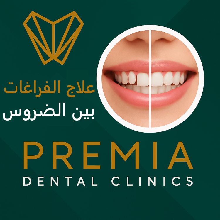 علاج الفراغات بين الضروس