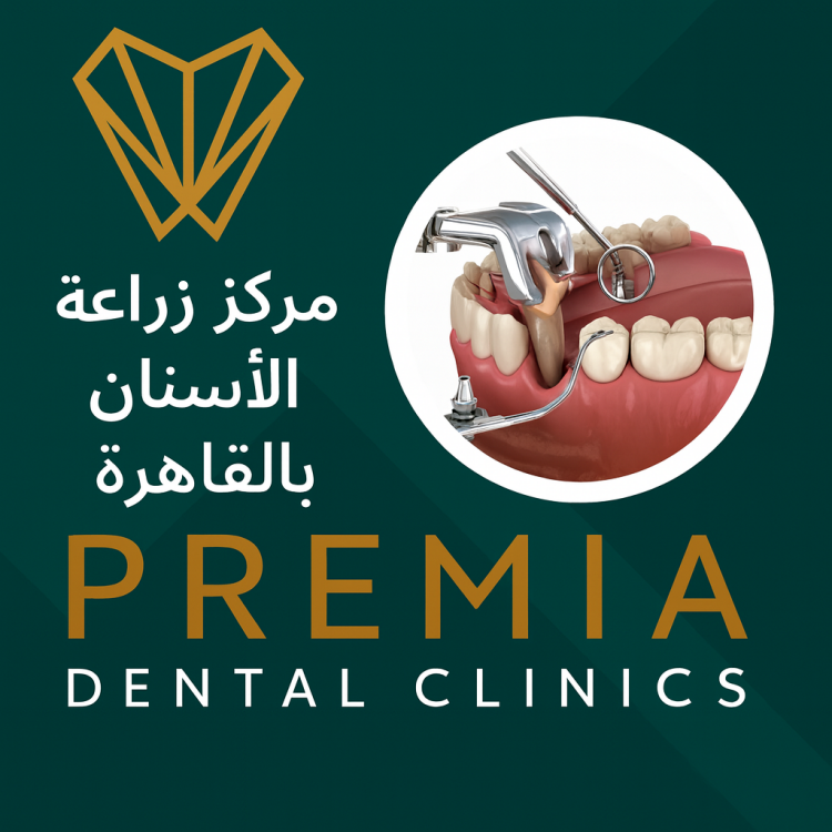 مركز زراعة الاسنان بالقاهرة: أحدث التقنيات لابتسامة ثابتة وطبيعية