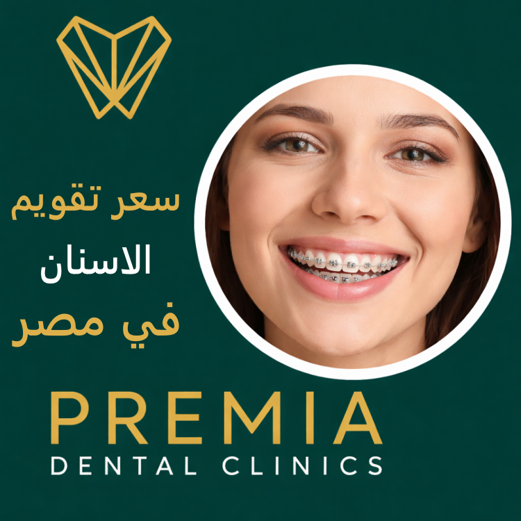 سعر تقويم الاسنان في مصر 