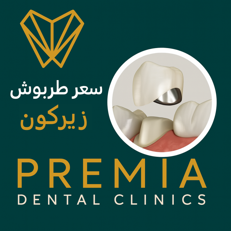 سعر طربوش زيركون: دليلك لاختيار أفضل طربوش أسنان بلا قلق