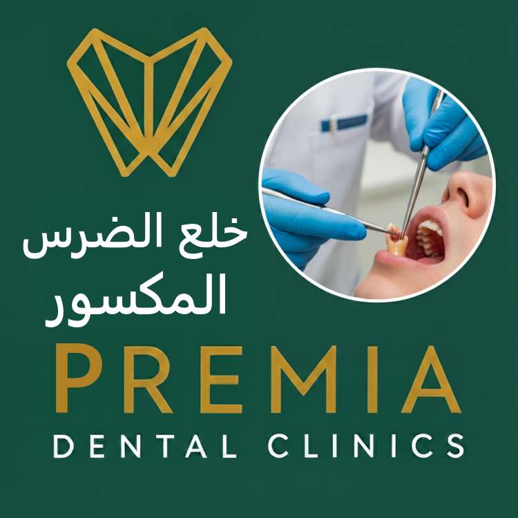 متى يصبح خلع الضرس المكسور ضرورة لا غنى عنها؟ 