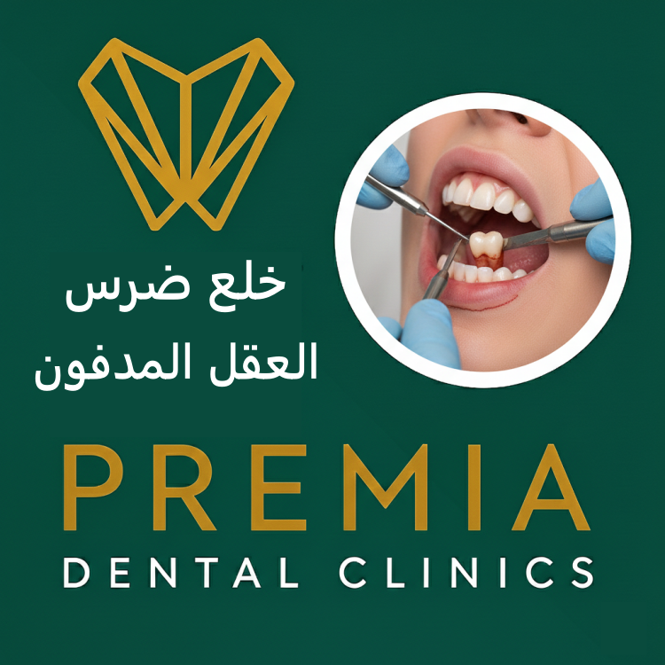 خلع ضرس العقل المدفون 