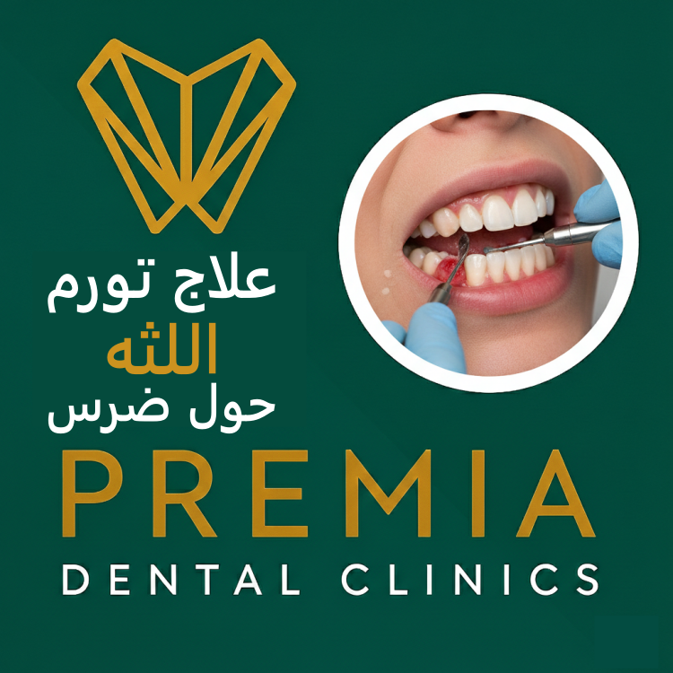 علاج تورم اللثه حول ضرس