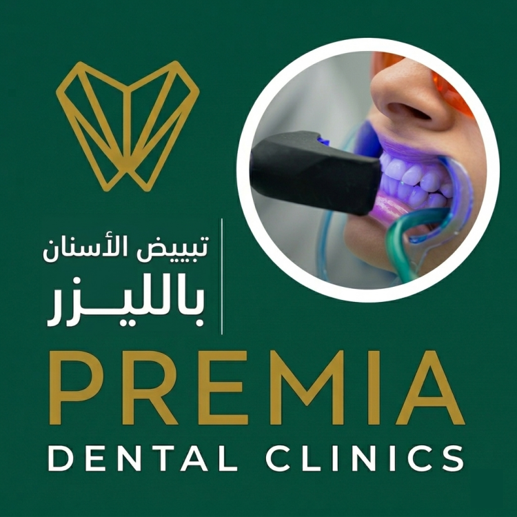 تبييض الاسنان بالليزر | النتائج والاسعار والتجربة