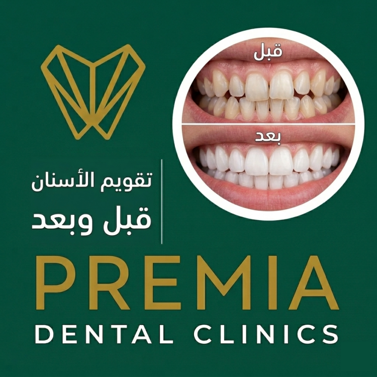 تقويم الاسنان قبل وبعد | الفرق الواضح في الابتسامة