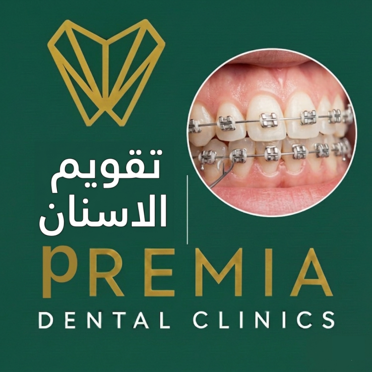تقويم الاسنان: الانواع والاسعار والخطوات 2026