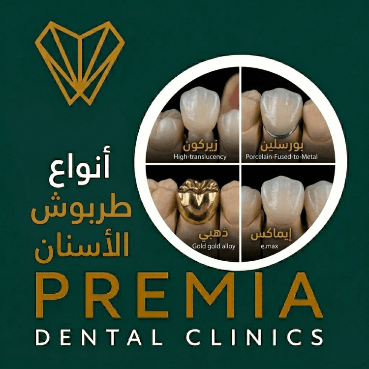 انواع طربوش الاسنان