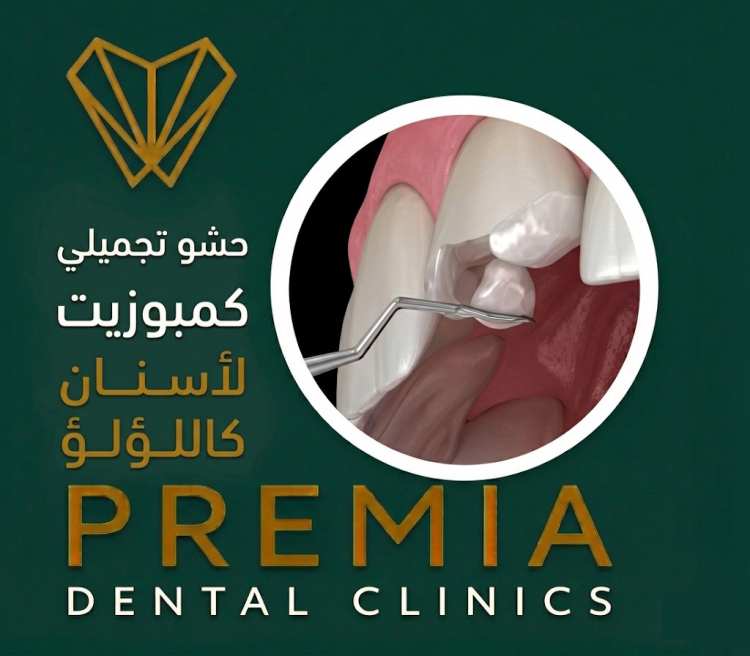 حشو كمبوزيت: دليلك الشامل لابتسامة طبيعية في 2026