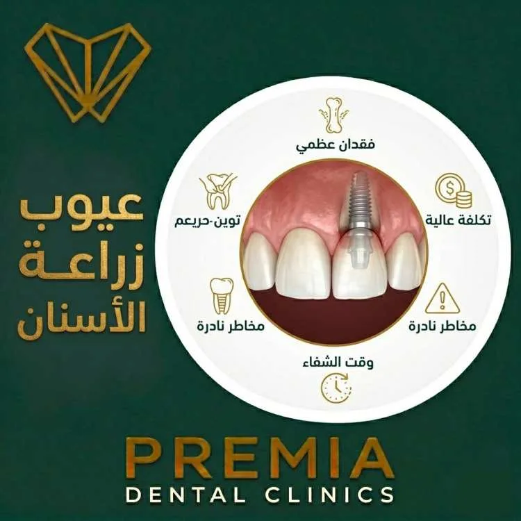 عيوب زراعة الاسنان: هل هي حقيقية؟ وكيف تتجنبها بخطوة واحدة؟ 